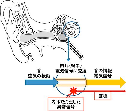 耳鳴 時間|耳鳴りとは？発生する仕組みと原因、適切に治療・対。